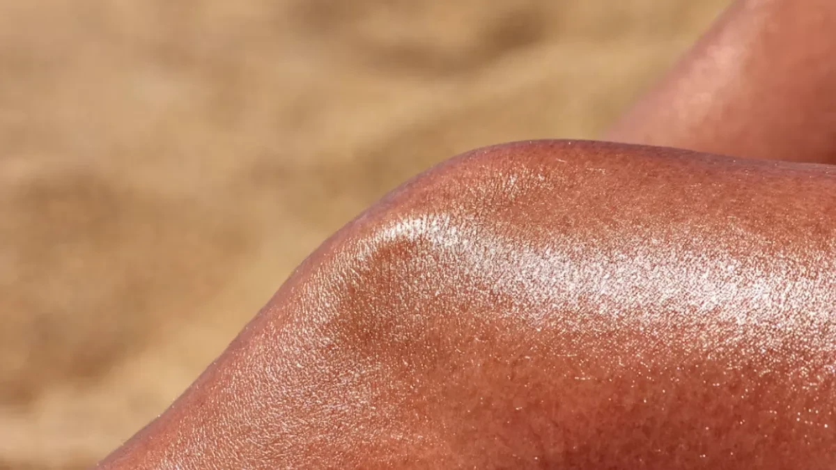 Evo šta zaista pomaže kada izgorite na suncu