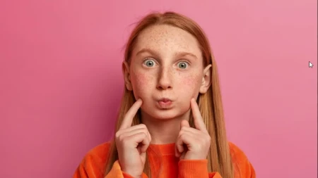 Sunce, gen "MC1R" i melanin: Zašto nam ljeti lice i tijelo prekriju pjege?