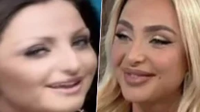 Maja Berović otkrila ko ju je nagovorio na prve estetske korekcije i kako je izgledala na početku karijere