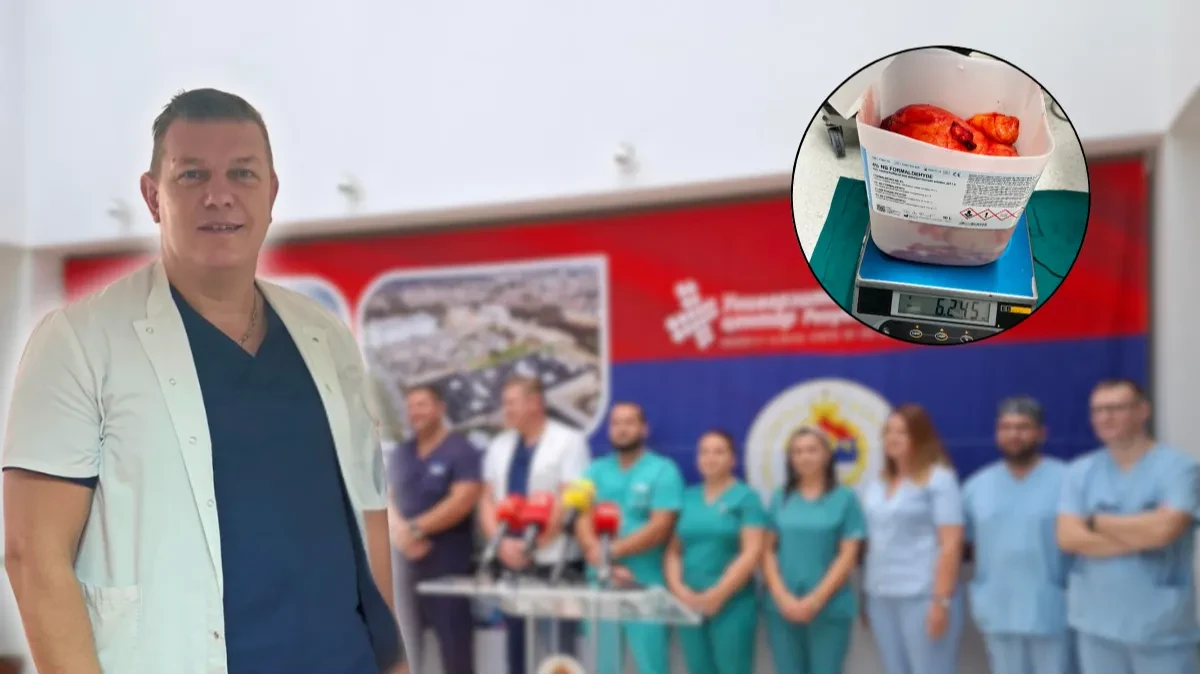Dr Velibor Simetić o istorijskoj operaciji tumora od 6 kilograma: "Sujeta u medicini ubija, pacijenta iz Teslića spasio čitav tim" (VIDEO)