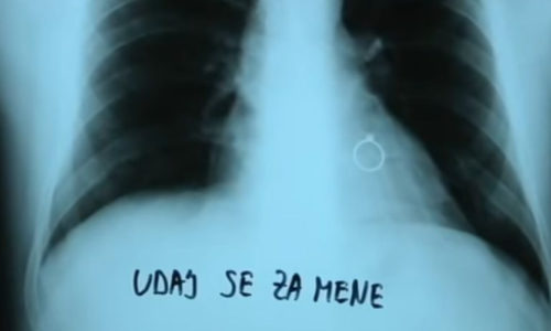 KAKVA PROSIDBA: Uz snimak pluća i prsten, dovitljivi Gabrijel zaprosio doktorku Tamaru (VIDEO)