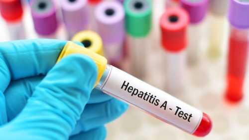 hepatitis a epidemija