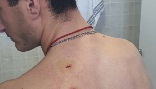 NOVI SVIREPI NAPAD NA KOSMETU! Srpski mladić (20) izboden nožem u selu kod Vitine, oglasio se Vučić (FOTO)