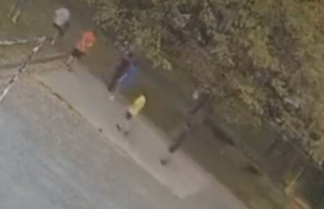 (UZNEMIRUJUĆI VIDEO) Pas ugrizao dječaka, vlasnice snimljene kako bježe