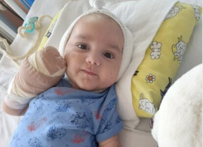 POMOZIMO MALOM LAZARU Bebi zbog teške bolesti amputirani prsti nogu i ruku (FOTO)