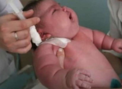 Beba rođena sa 7 kilograma bila je prava senzacija: Pogledajte kako danas izgleda (FOTO)