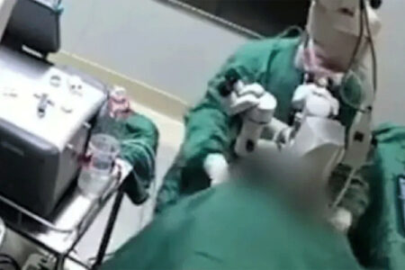 Hirurg pretukao ženu tokom operacije (VIDEO)
